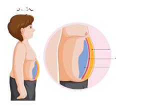 The Science of Breaking Down Fat: Understanding How the Body Metabolizes Fat and How to Target Belly Fat