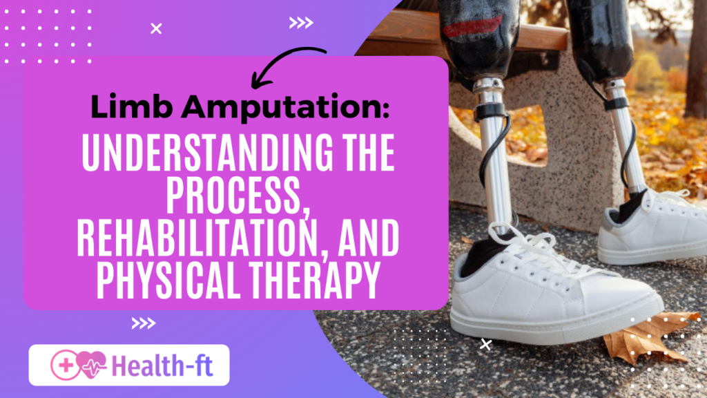 Limb Amputation: Understanding the Process, Rehabilitation, and Physical Therapy