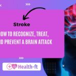 Stroke: How to Recognize, Treat, and Prevent a brain attack