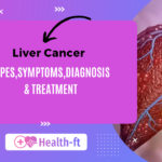 Liver Cancer: Types, Symptoms, Diagnosis and Treatment