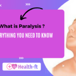 What is Paralysis?: Every thing you need to know