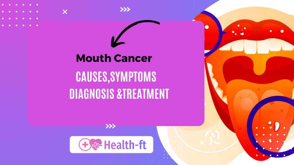 Mouth Cancer :Causes Symptoms Diagnosis & Treatment