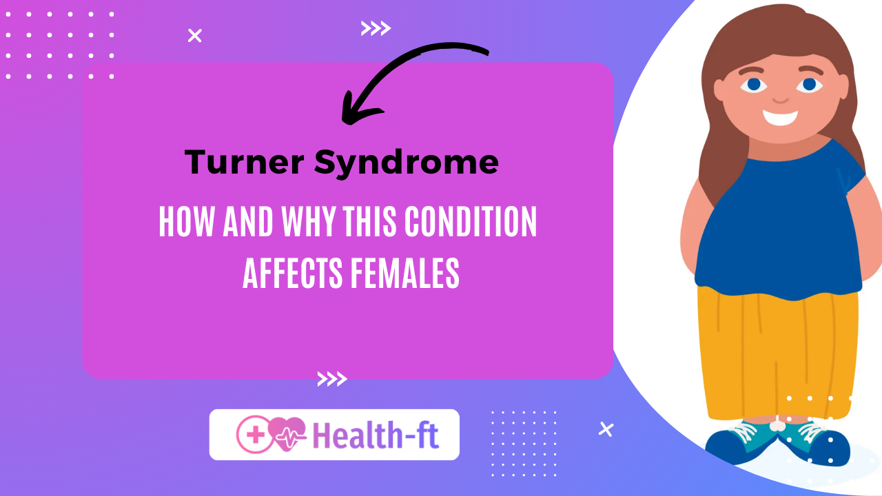 Turner Syndrome causes, symptoms, and treatment in females