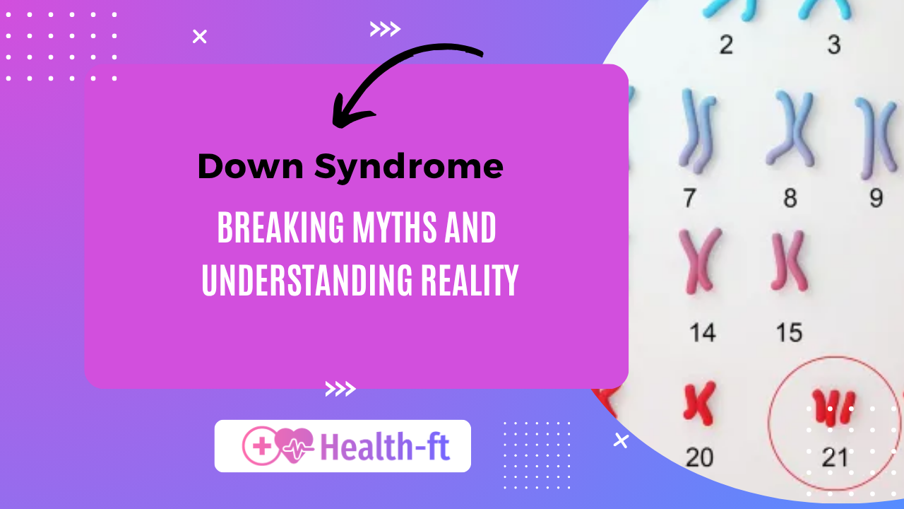 Down Syndrome facts, causes, and understanding reality