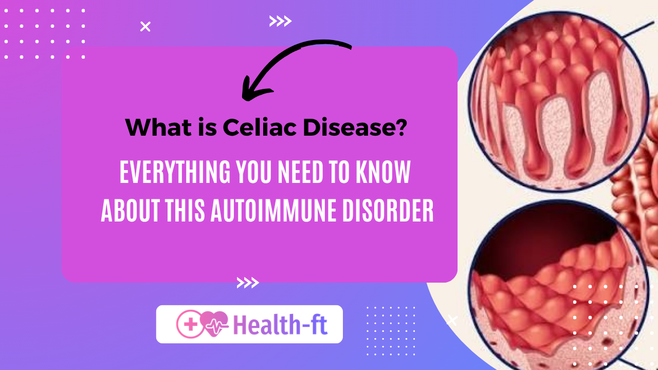 Celiac disease symptoms, causes, diagnosis, and treatment